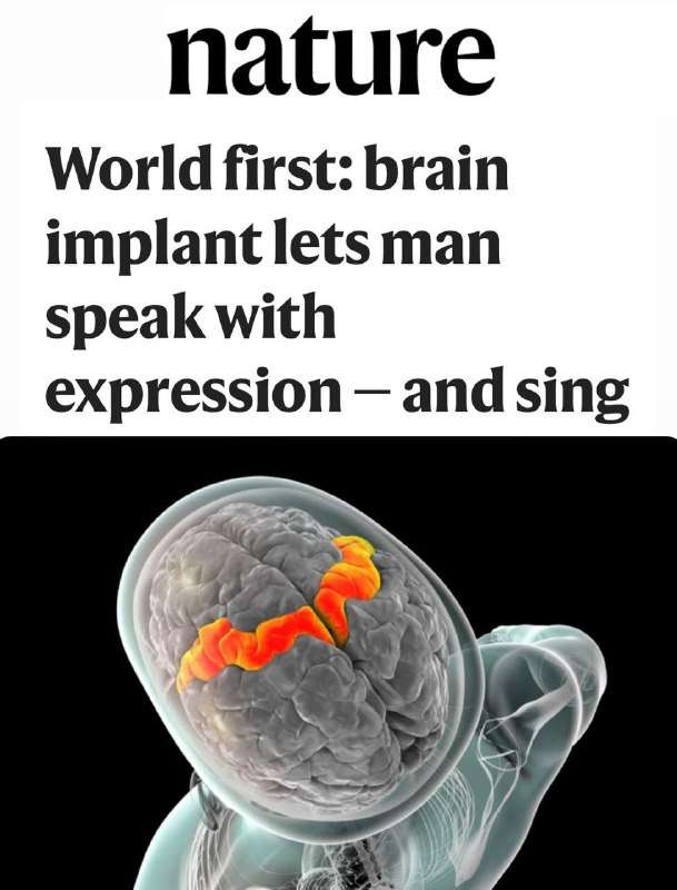 Новости - Учёные создали мозговой имплант, который позволяет человеку говорить и петь силой мысли. Учёные создали мозговой имплант, который позволяет человеку говорить и петь силой мысли. - новости